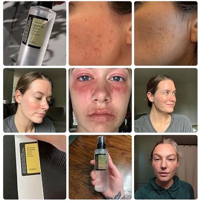 Hydrating Moisturizing Face Serum Snail Mucin 96% Power Repairing Essence 3.38 Fl.Oz 100ml