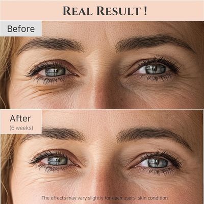 30ml Revive Eye Serum For Puffy Eye Bags Fine Lines Dark Circles Wrinkles