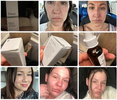 High Strength Face Retinol Serum For Anti Aging Skin Smoothing 4.2oz