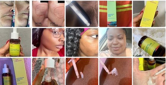 Alcohol Free Skin Molecules Discoloration Correcting Serum Tranexamic Acid Niacinamide For Dark Age Spots
