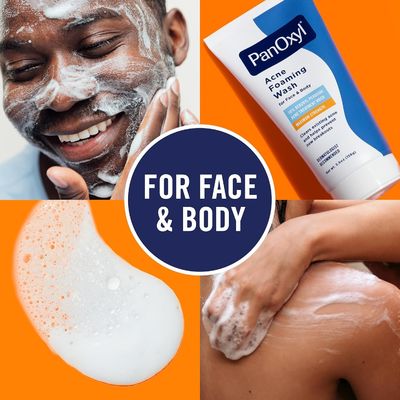 Antimicrobial Benzoyl Peroxide Acne Foaming Wash Facial Cleanser Unscented